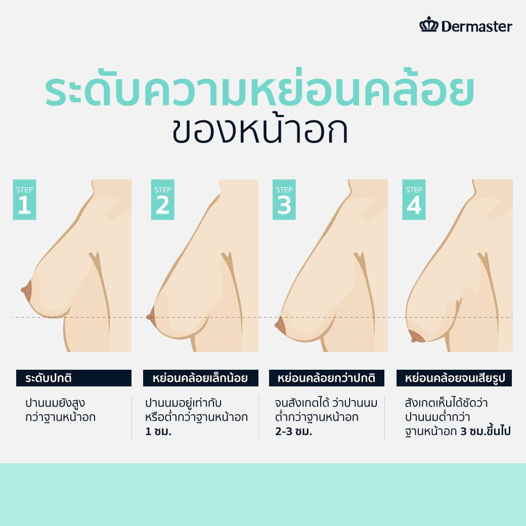 LINE_ALBUM_รีวิวยกกระชับหน้าอก_250130_16