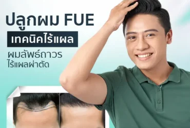 ปลูกผมถาวร FUE |  ไม่ต้องผ่าตัด ไม่ต้องพักฟื้น เทคนิคเฉพาะ Dermaster