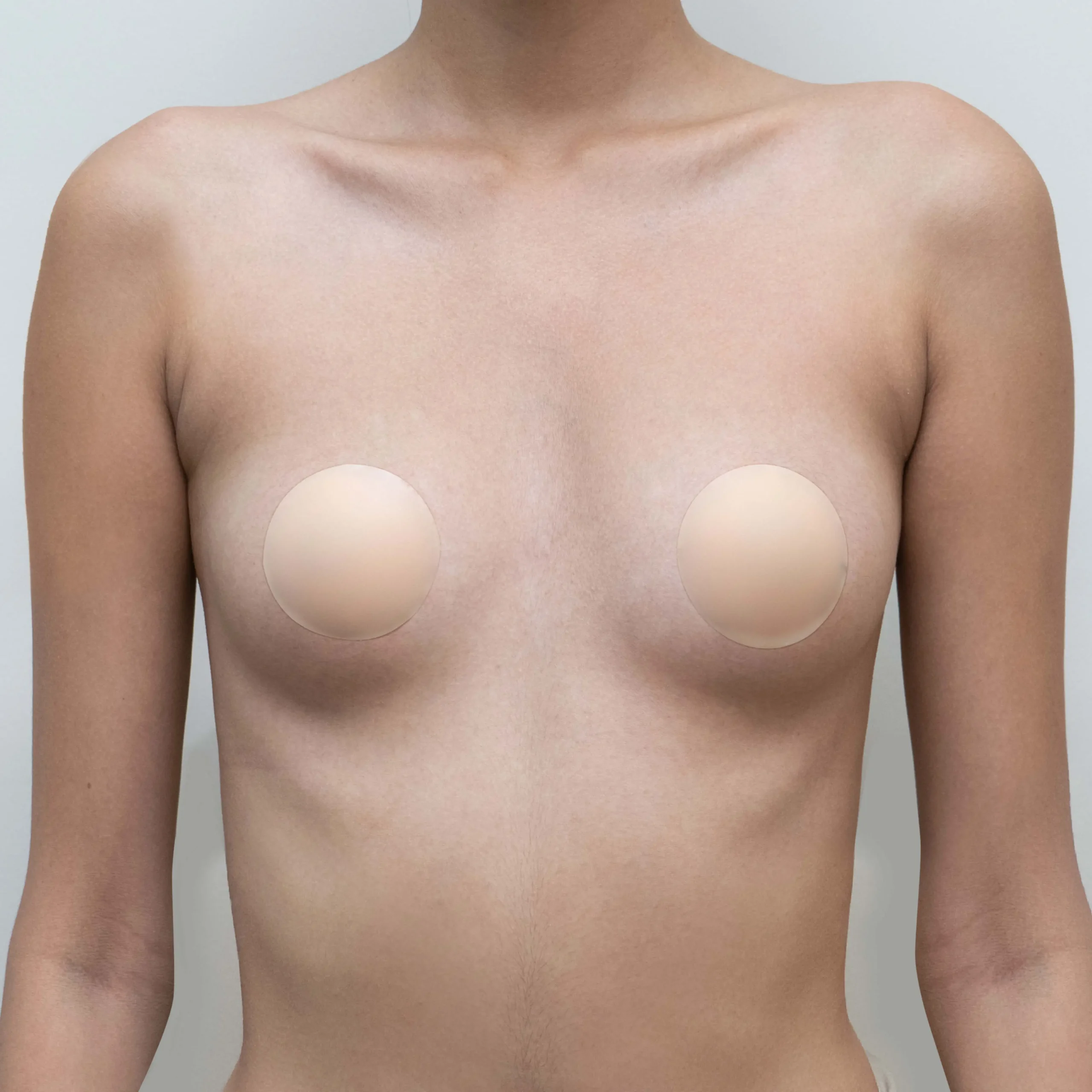 maprang_breast-augmentation-thailand-11-before