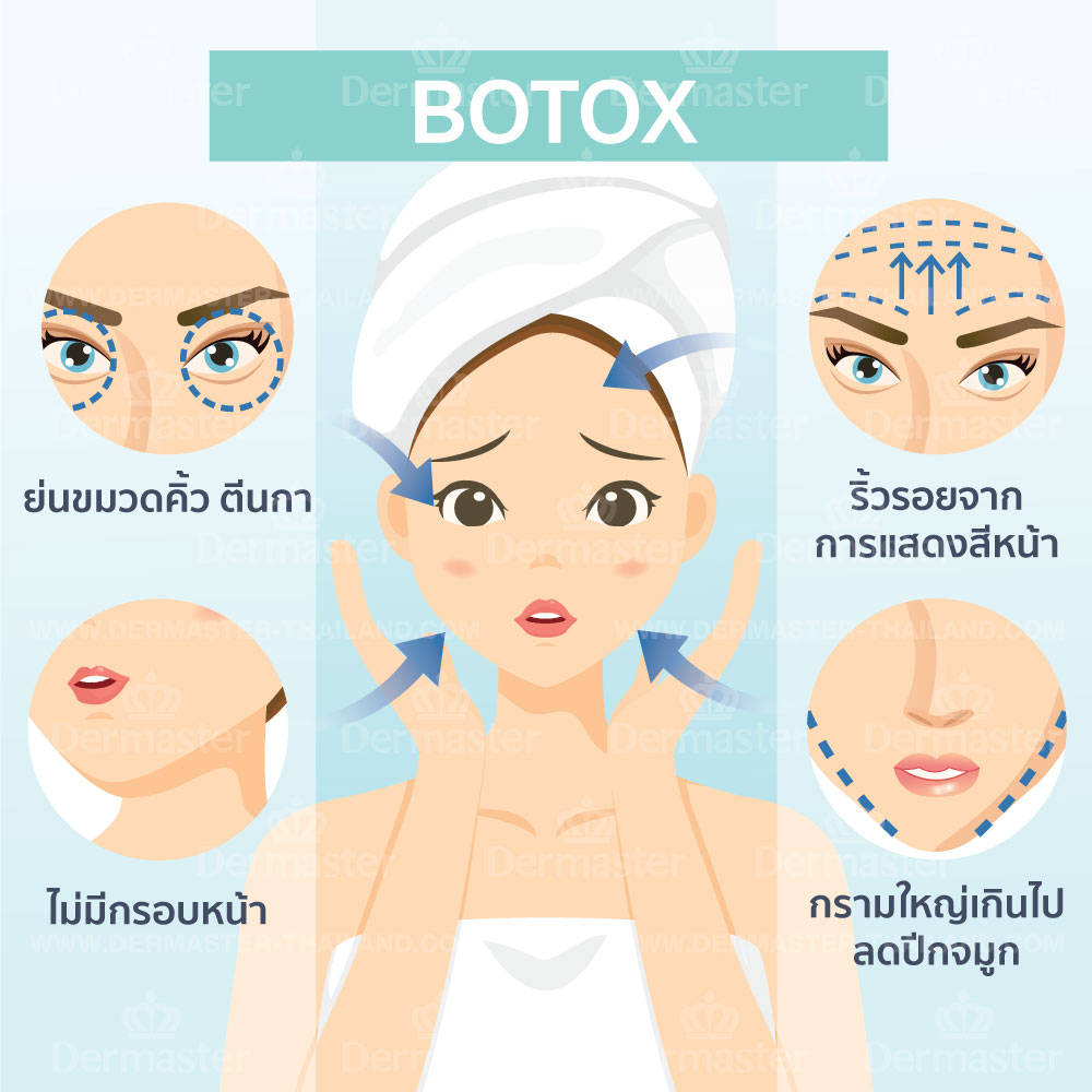 problem-botox