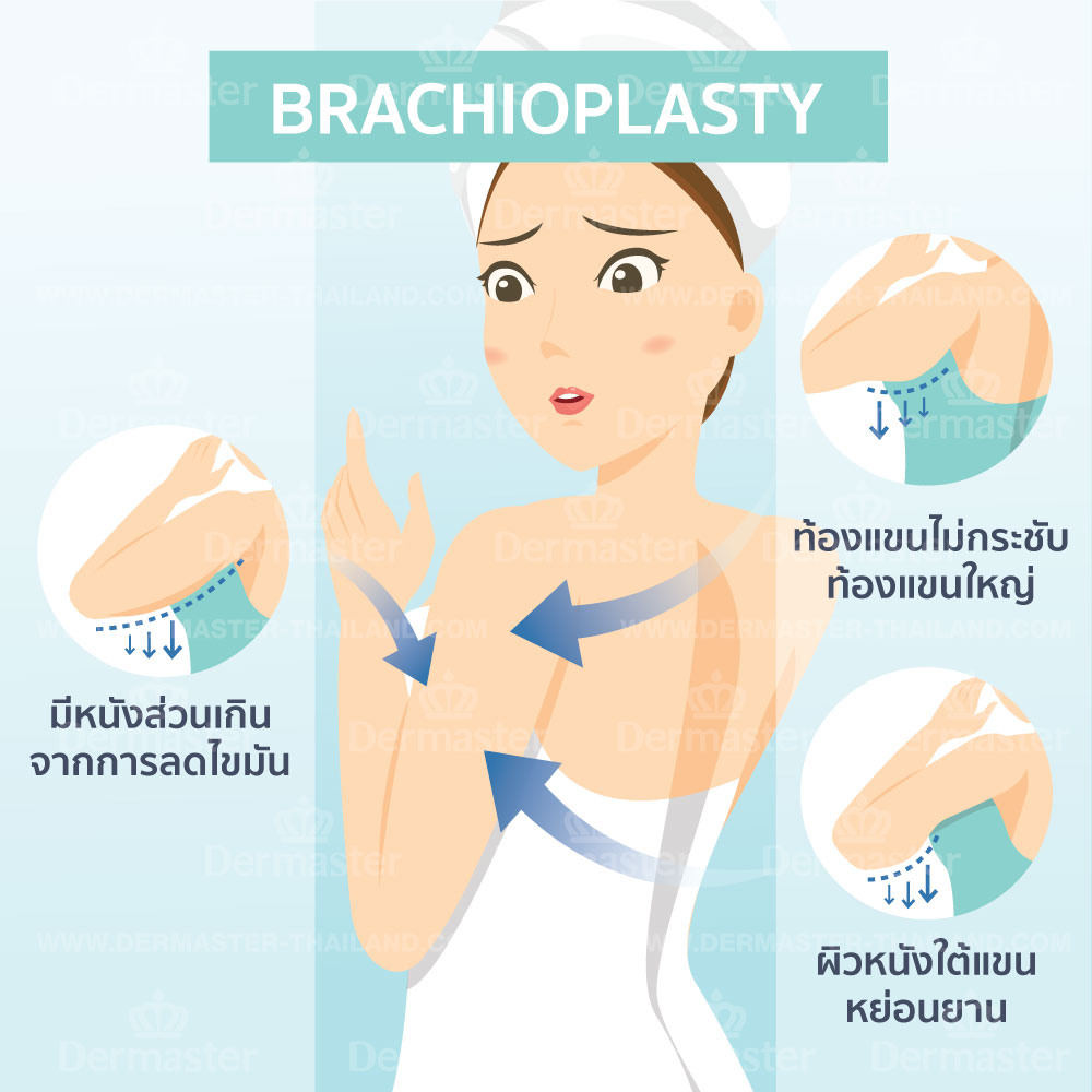 problem-brachioplasty