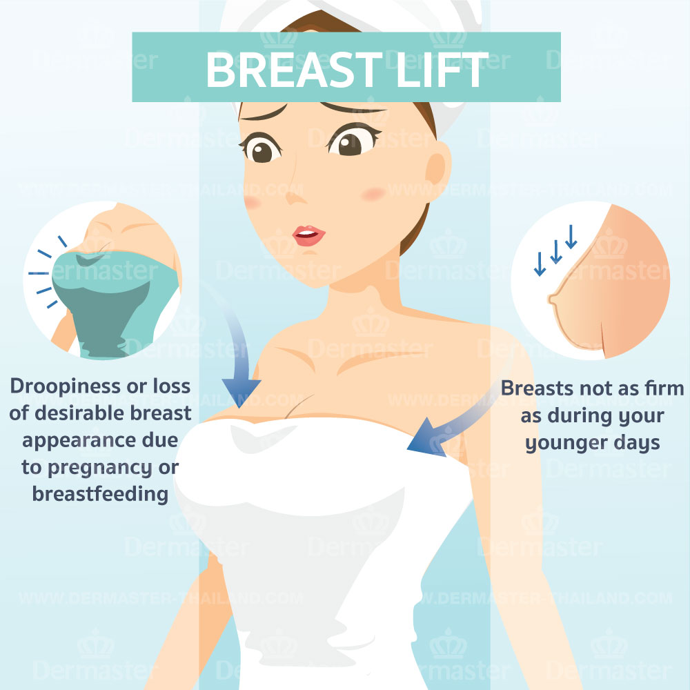 problem-breast-lift-en