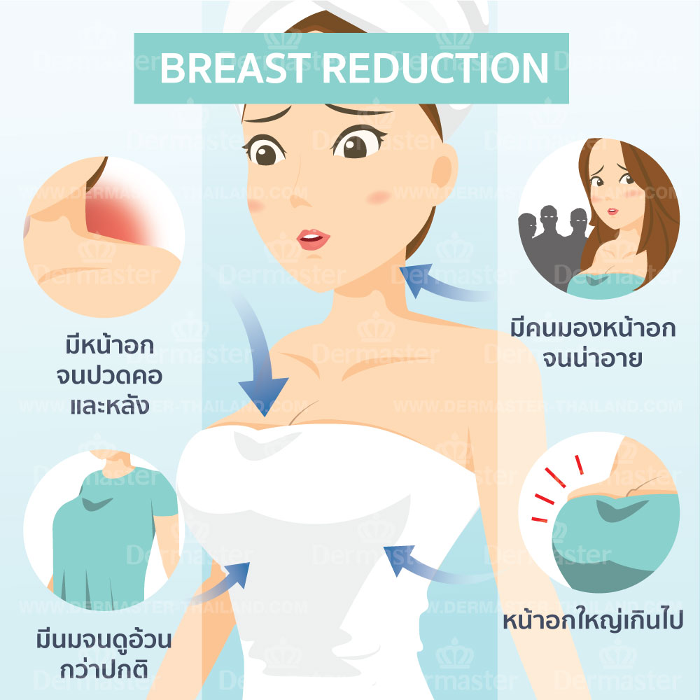 problem-breast-reduction