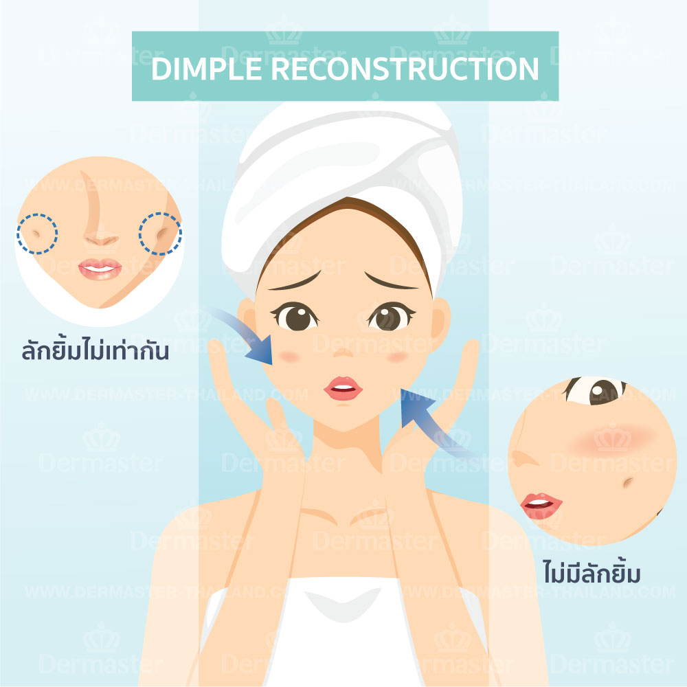 problem-dimple-reconstruction