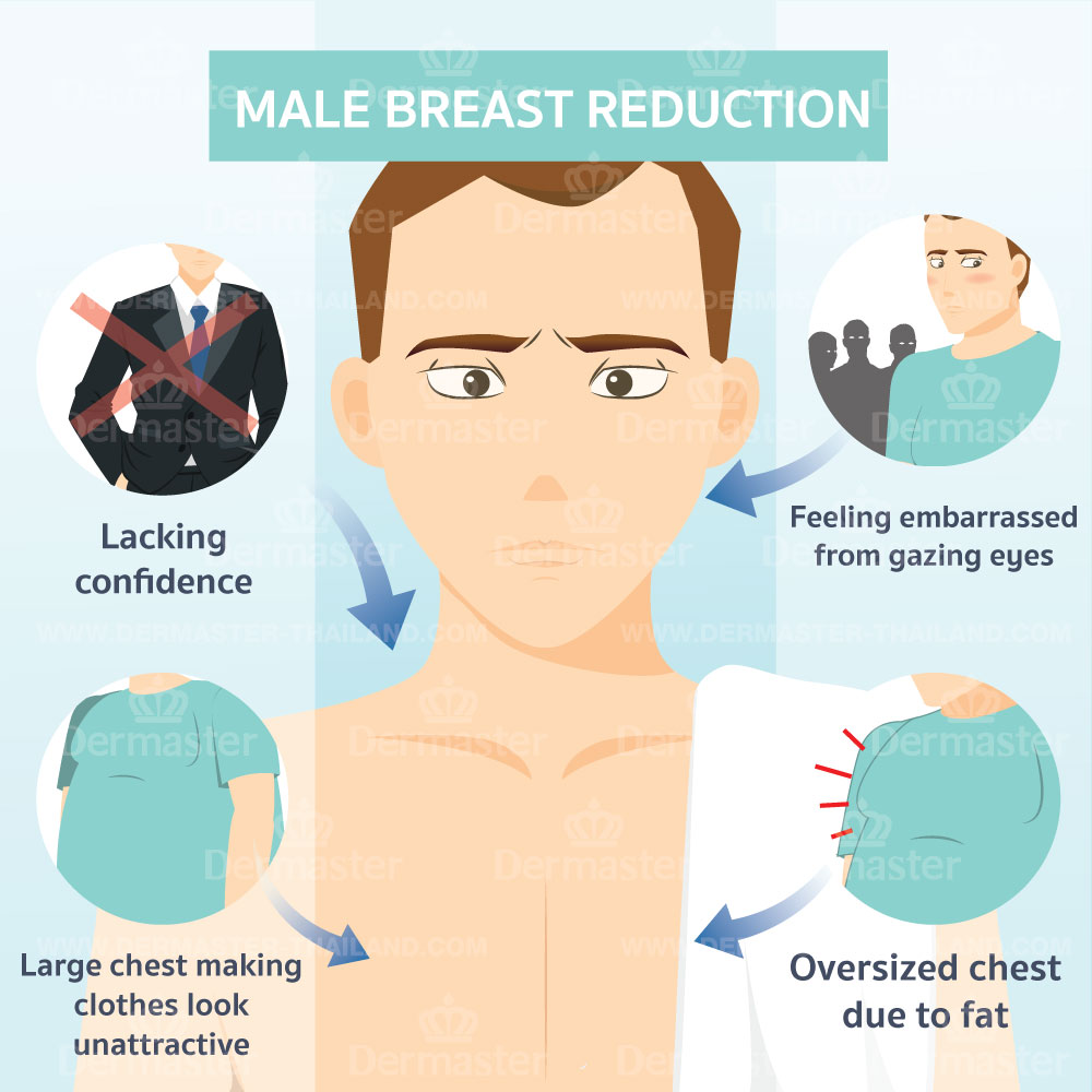 problem-male-breast-reduction-en