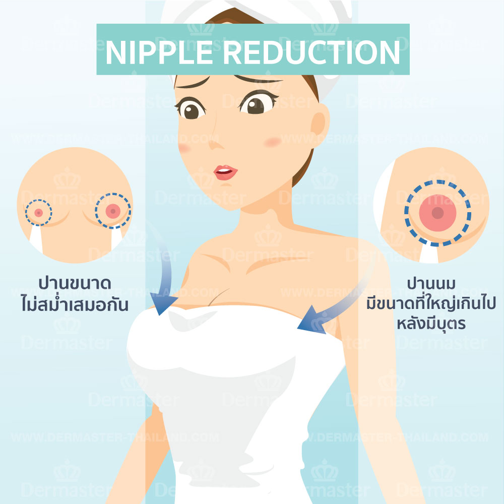 problem-nipple-reduction