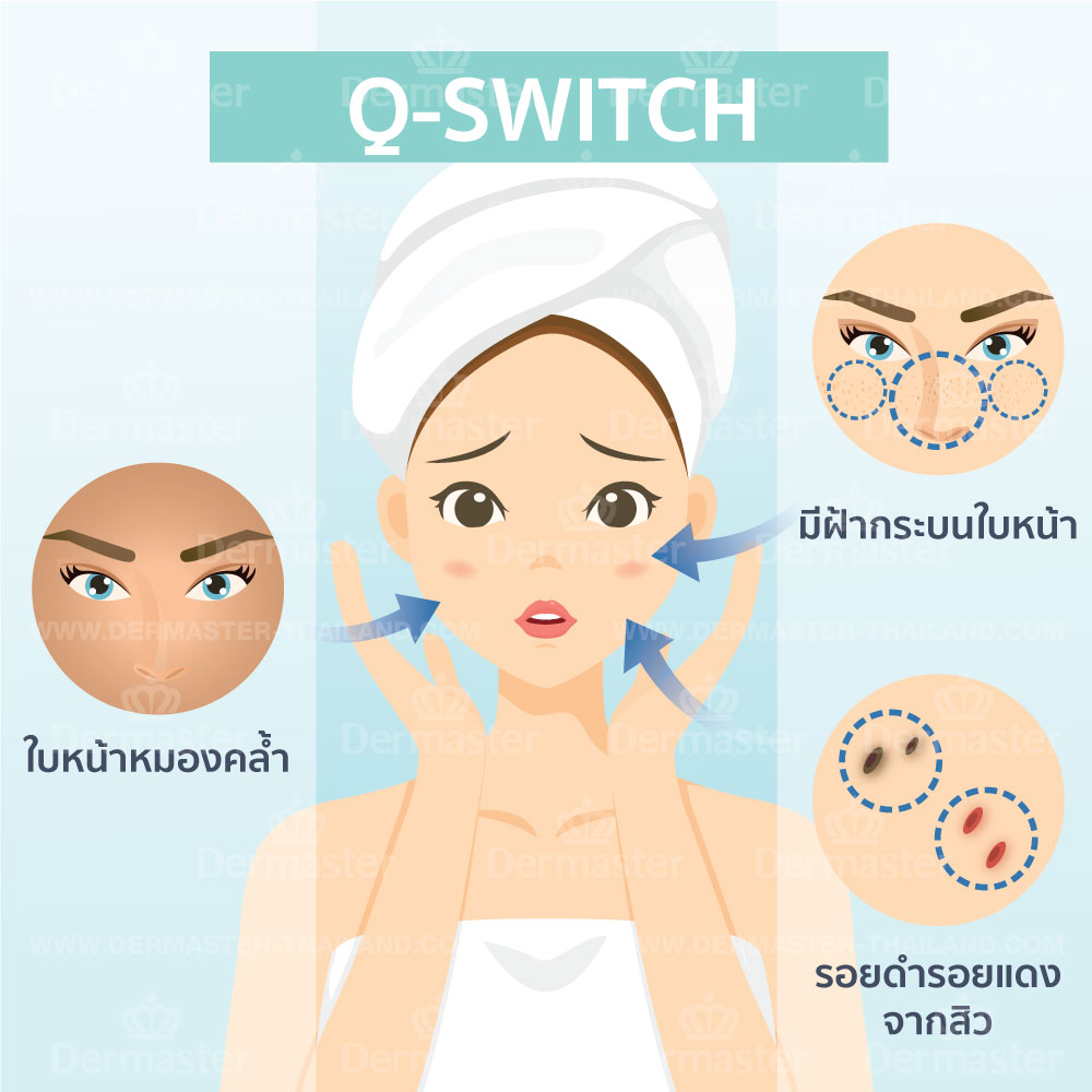 problem-q-switch