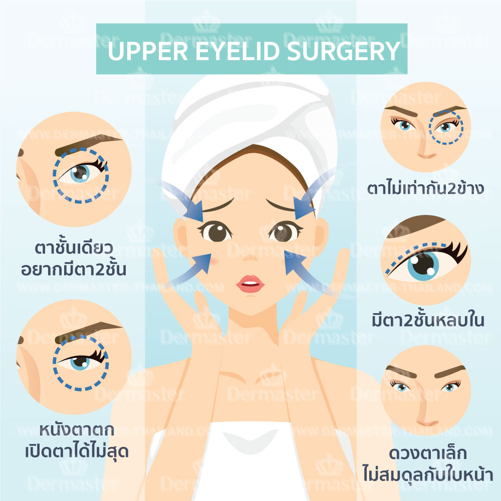 problem-upper-eyelid-surgery