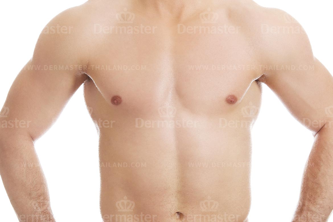 service-dermaster-male-breast-reduction-4