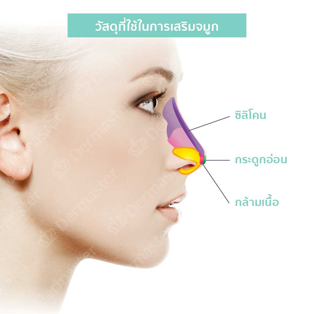 why-dermaster-nose-surgery-1