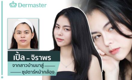 โตแล้วแม่อนุญาตให้ทำสวยได้ เดอมาสเตอร์จัดให้เสริมจมูกทรงสวยเป็นธรรมชาติสวยเป๊ะทุกมุม