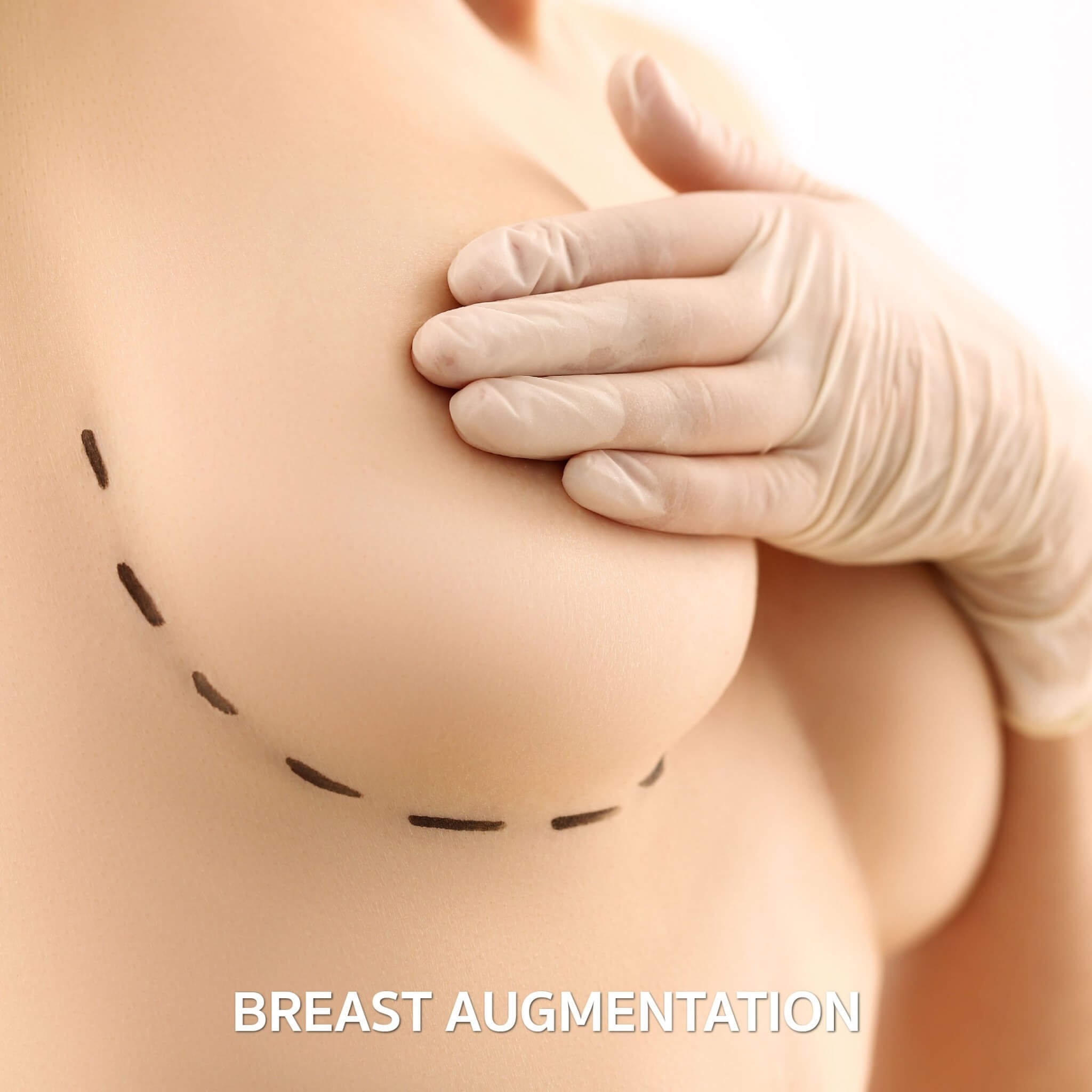 dermaster-poppular-services-breast-augmentation