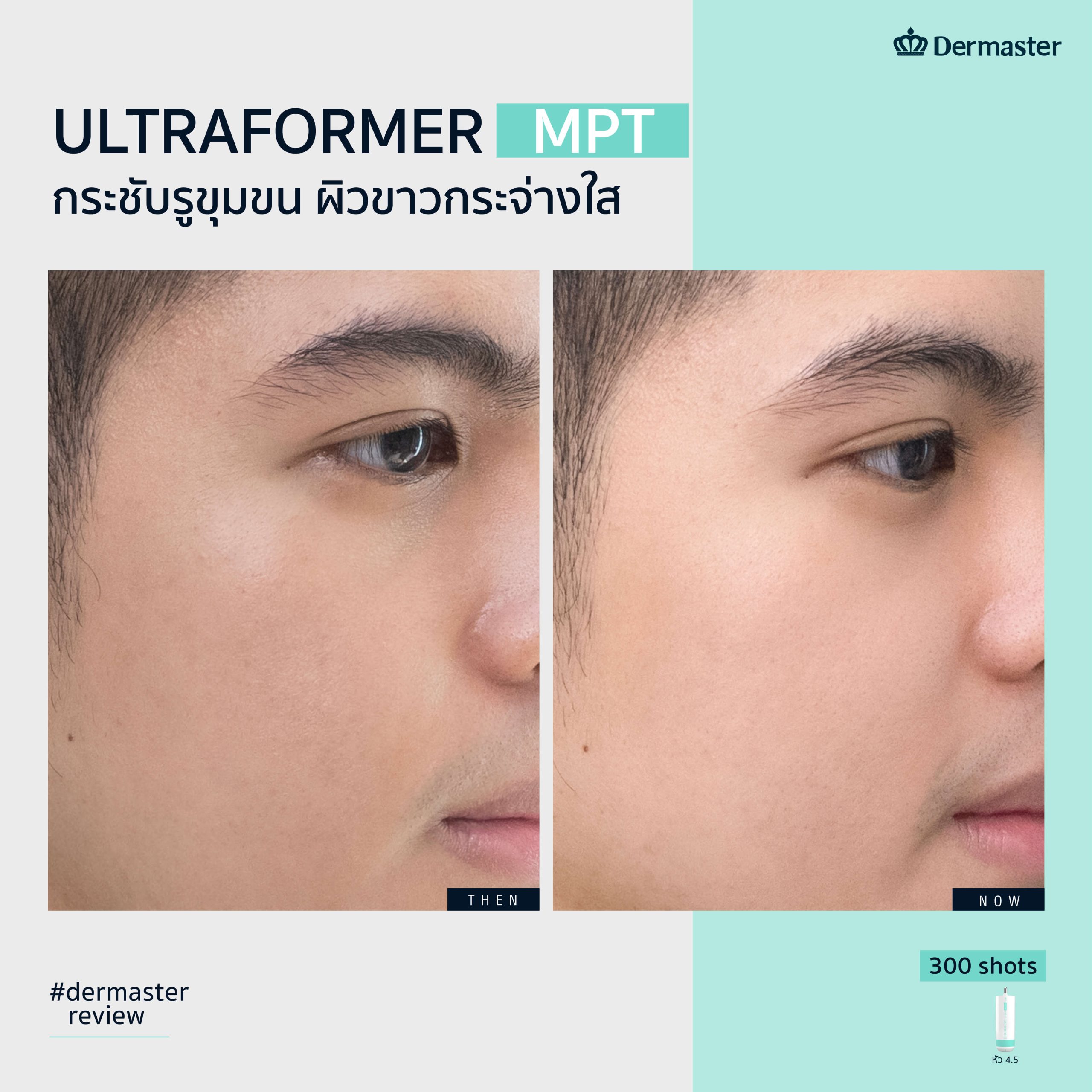 ULTRA BOOSTER ณัฐ_3
