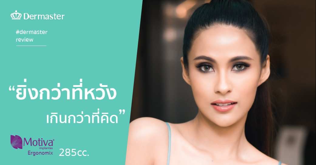 รีวิว – เสริมหน้าอก Motiva Ergonomix2 “คุณบิว ณัฏฐา ทองแก้ว” อดีต Top 20 Miss Universe Thailand 2020