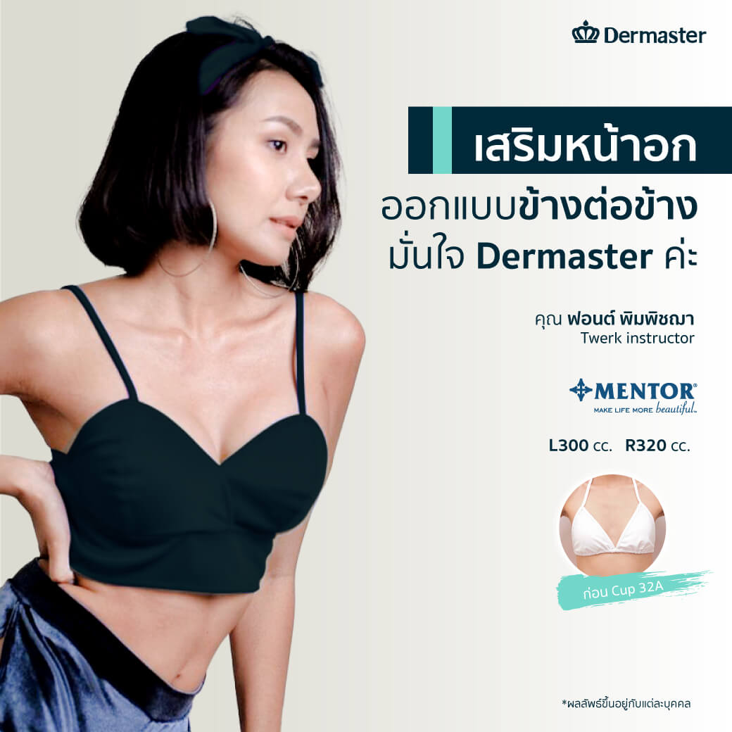 dermaster-thailand-breast-augmentation-มีนามีนม-14