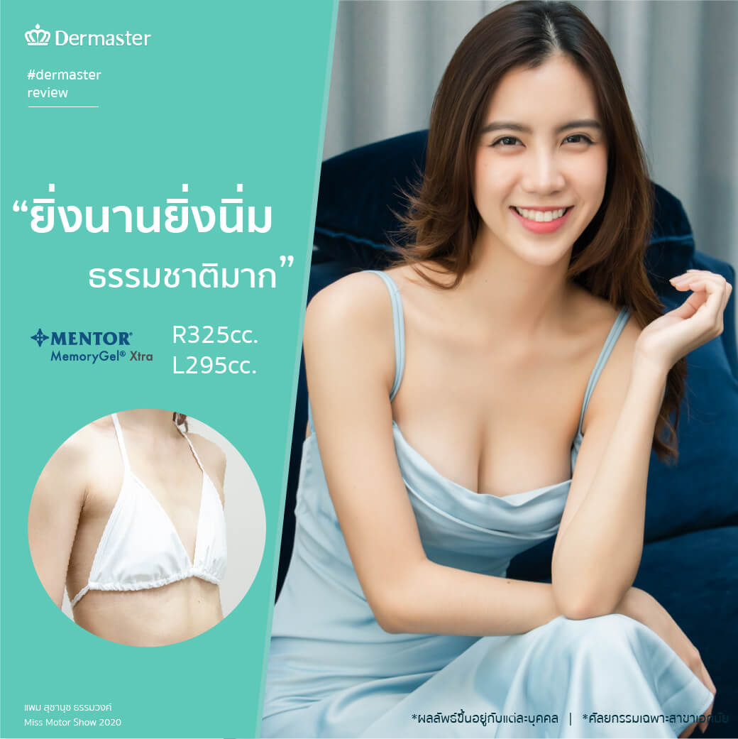 dermaster-thailand-breast-augmentation-มีนามีนม-2