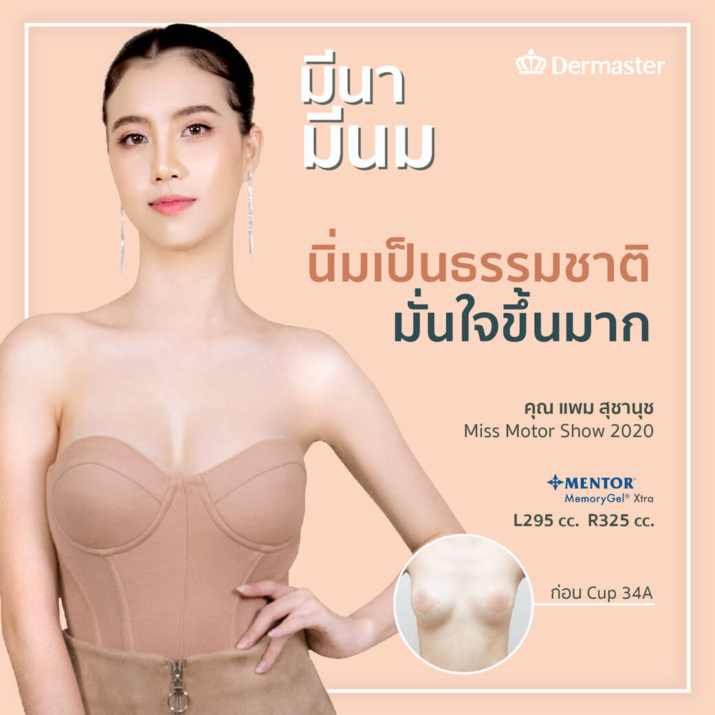dermaster-thailand-breast-augmentation-มีนามีนม-3