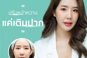 รีวิว – Filler ปากสายเกาหลี โดยคุณเจย์ Influencer