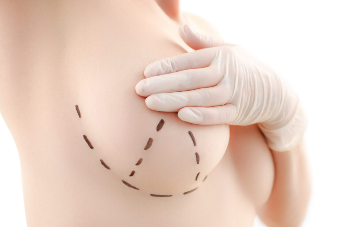 ราคาและระยะเวลาพักฟื้น เปรียบเทียบวิธียกกระชับหน้าอกในปี 2025