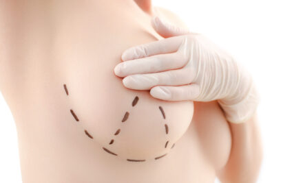 ราคาและระยะเวลาพักฟื้น เปรียบเทียบวิธียกกระชับหน้าอกในปี 2025