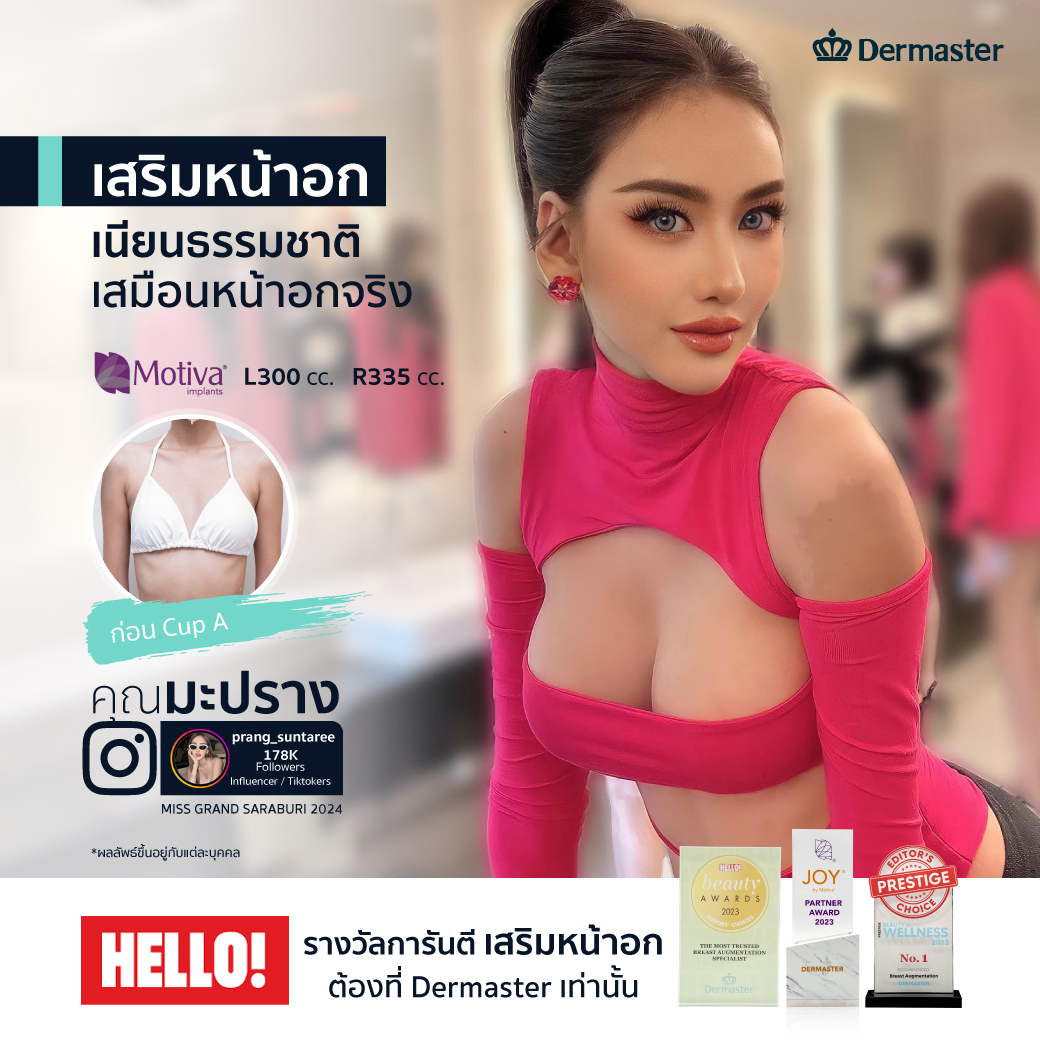 รีวิวจากลูกค้า-เสริมหน้าอก5