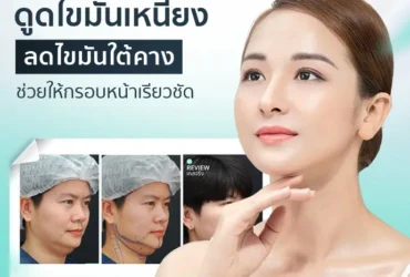 ดูดไขมันนมน้อยคืออะไร?