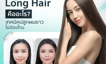 ปลูกผม Long Hair คืออะไร? เทคนิคปลูกผมยาว ไม่ต้องโกน