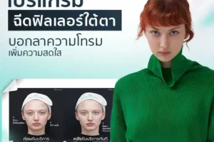 โปรแกรมฉีดฟิลเลอร์ใต้ตา บอกลาความโทรม เพิ่มความสดใส
