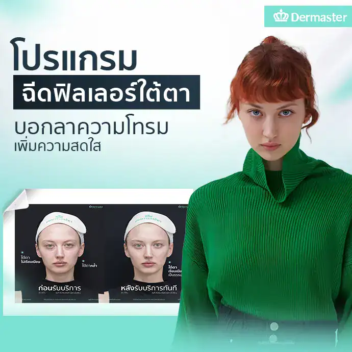 โปรแกรมฉีดฟิลเลอร์ใต้ตา บอกลาความโทรม เพิ่มความสดใส