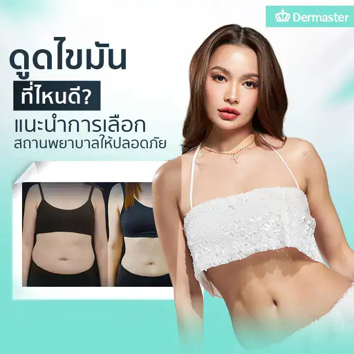 ดูดไขมันที่ไหนดี? แนะนำการเลือกสถานพยาบาลให้ปลอดภัย