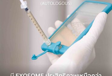 MCT EXOSOME