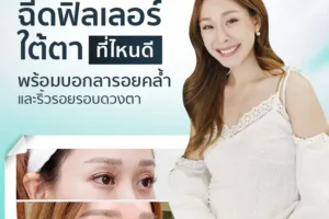 ฉีดฟิลเลอร์ใต้ตาที่ไหนดี? พร้อมบอกลารอยคล้ำและริ้วรอยรอบดวงตา