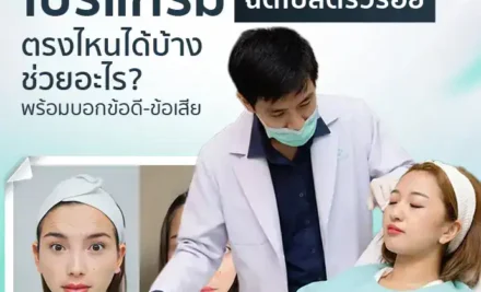 โปรแกรมฉีดโบลดริ้วรอยตรงไหนได้บ้าง ช่วยอะไร? พร้อมบอกข้อดี-ข้อเสีย