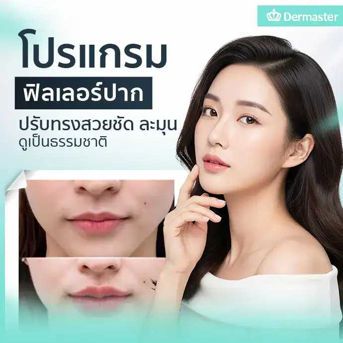 โปรแกรมฟิลเลอร์ปาก ปรับทรงสวยชัด ละมุน ดูเป็นธรรมชาติ