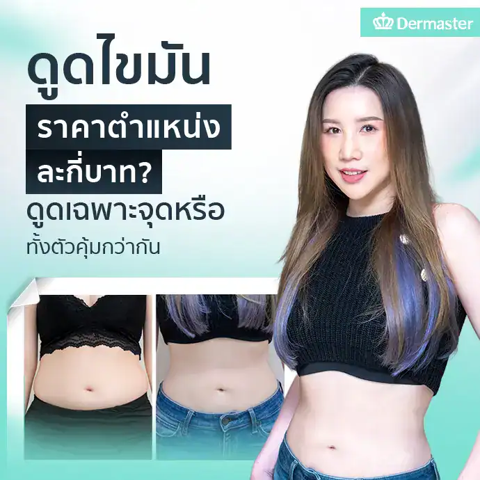ดูดไขมัน ราคาตำแหน่งละกี่บาท ดูดเฉพาะจุดหรือทั้งตัวคุ้มกว่ากัน?