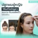 ปลูกผมผู้หญิง วิธีแก้ไขปัญหาผมบาง เห็นผลลัพธ์ไว ไม่ต้องโกน