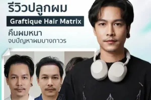 รีวิวปลูกผม Graftique Hair Matrix คืนผมหนา จบปัญหาผมบางถาวร