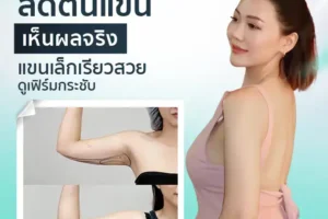 ลดต้นแขนเห็นผลจริง แขนเล็กเรียวสวยดูเฟิร์มกระชับ