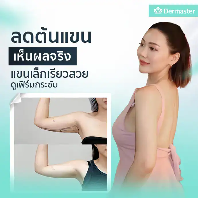 ลดต้นแขนเห็นผลจริง แขนเล็กเรียวสวยดูเฟิร์มกระชับ
