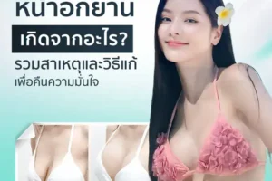 หน้าอกยานเกิดจากอะไร? รวมสาเหตุและวิธีแก้เพื่อคืนความมั่นใจ