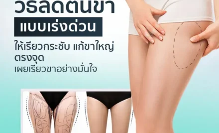 วิธีลดต้นขาแบบเร่งด่วน ให้เรียวกระชับ แก้ขาใหญ่ตรงจุด เผยหุ่นอย่างมั่นใจ