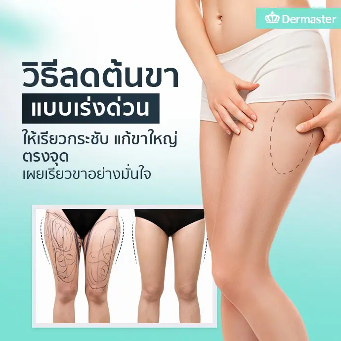 วิธีลดต้นขาแบบเร่งด่วน ให้เรียวกระชับ แก้ขาใหญ่ตรงจุด เผยหุ่นอย่างมั่นใจ