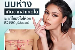 นมห่างเกิดจากสาเหตุใด จะแก้ไขยังไงให้อกสวยชิด ดูมีสัดส่วน?
