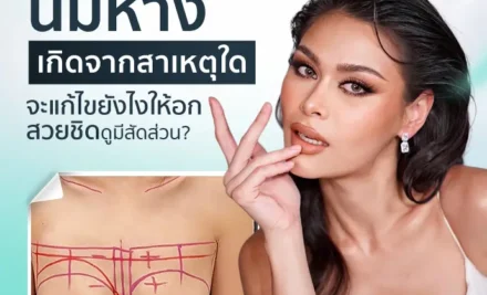 นมห่างเกิดจากสาเหตุใด จะแก้ไขยังไงให้อกสวยชิด ดูมีสัดส่วน?