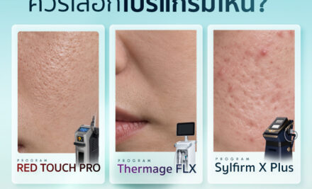 ผิวมีปัญหาแบบนี้ ควรเลือกโปรแกรมไหนดี? เจาะลึก 3 นวัตกรรมกู้ผิว RedTouch Pro, Thermage FLX และ SYLFIRM X