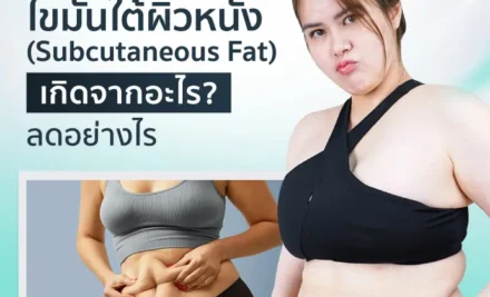 ไขมันใต้ผิวหนัง (Subcutaneous Fat) เกิดจากอะไร? ลดอย่างไร