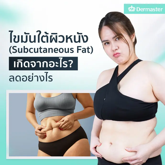 ไขมันใต้ผิวหนัง (Subcutaneous Fat) เกิดจากอะไร? ลดอย่างไร